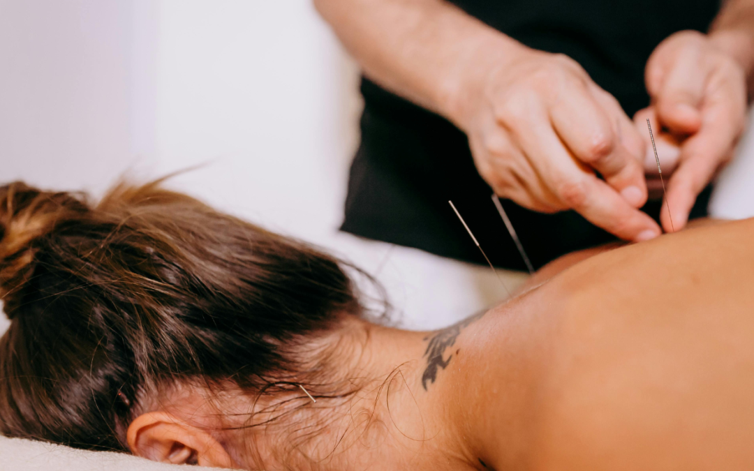 Acupuncture Treatment Plan