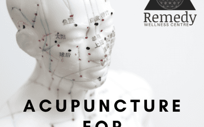Acupuncture for Everything