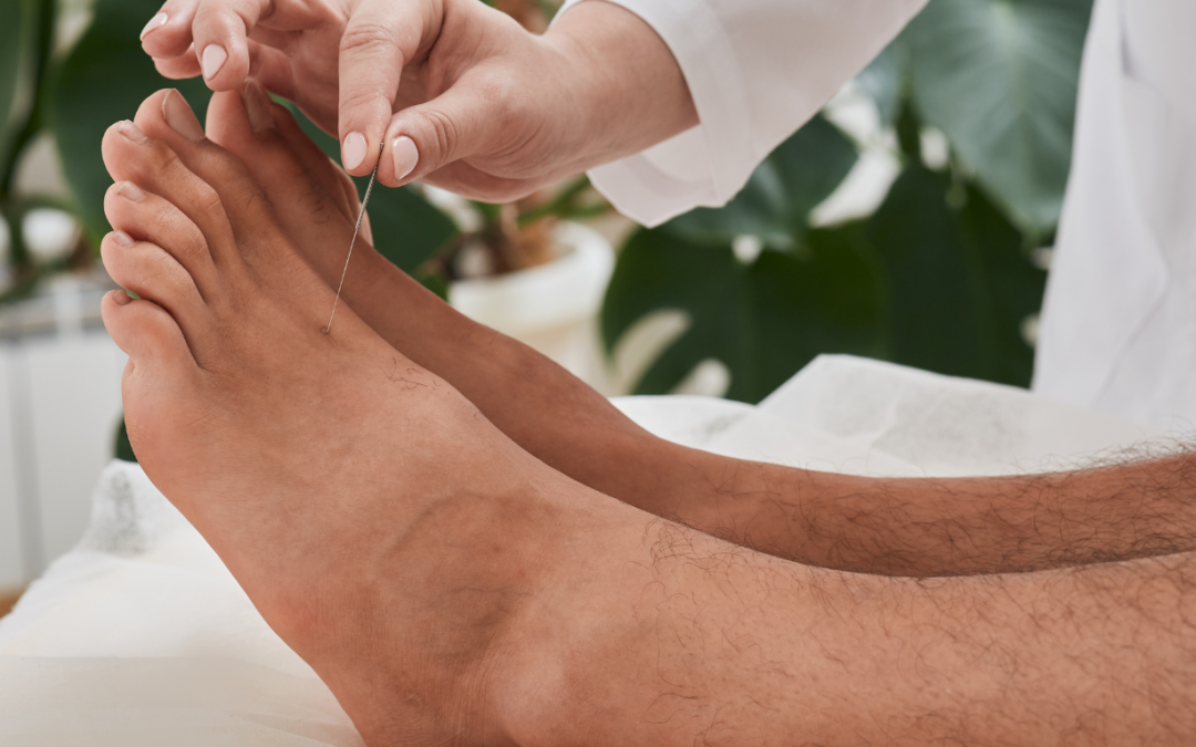 Acupuncture for pain relief and healing