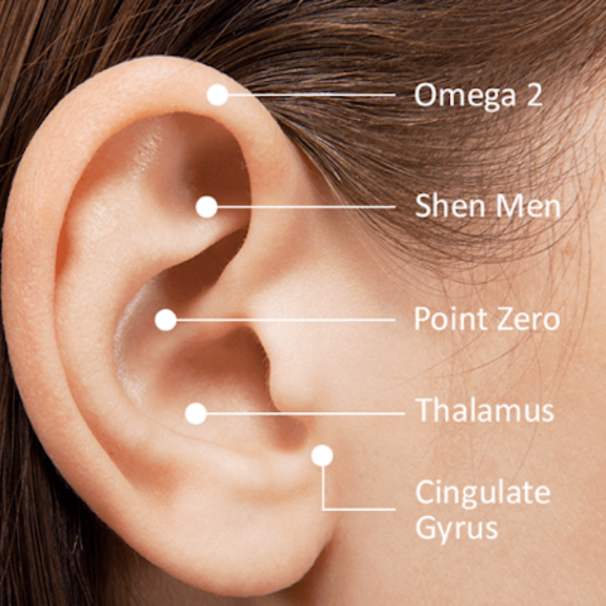 The 5 Ear Points Used for Battlefield Acupuncture