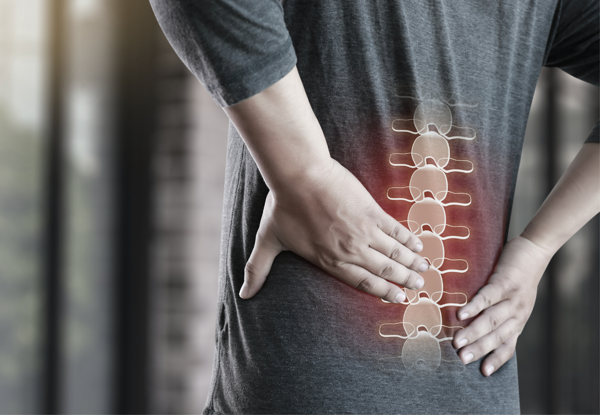 Chiropractic for Back Pain 1228 × 850 px