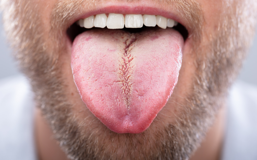 Tongue Diagnosis