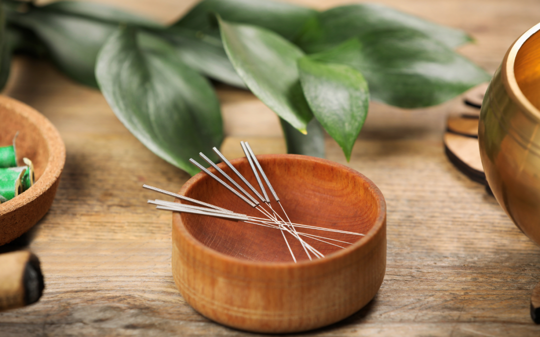 What to expect in your first acupuncture session