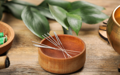 What to Expect at Your First Acupuncture Session