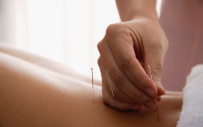 The Art of Healing with Traditional Chinese Medicine: Exploring the Benefits of Acupuncture at Remedy Wellness Centre