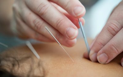 Discover the Therapeutic Potential of Acupuncture at Remedy Wellness Centre